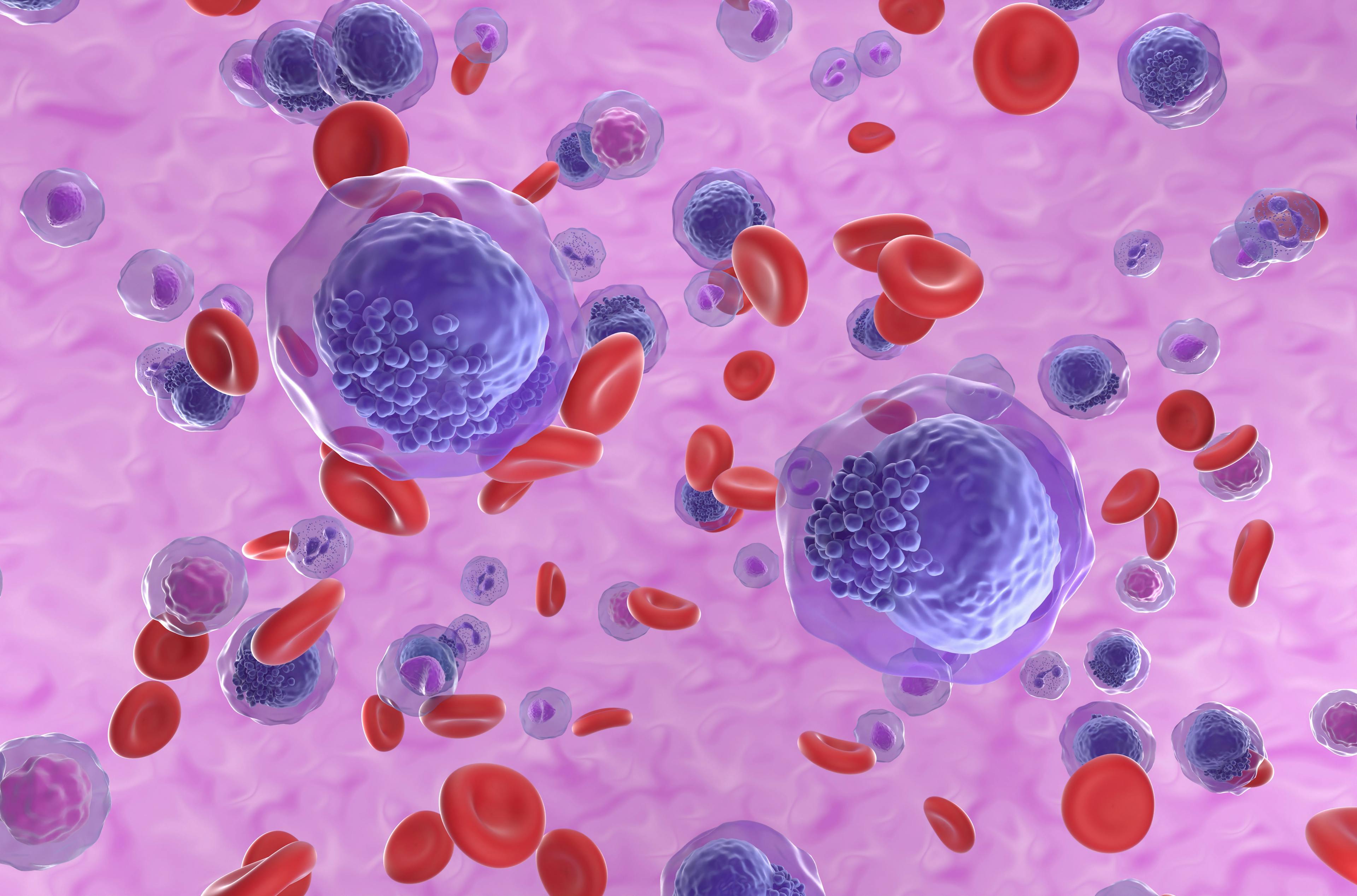 3D illustration of AML cells: © LASZLO - stock.adobe.com
