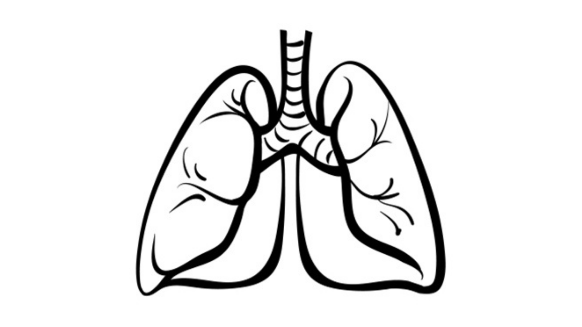 NRG1 Fusions in Lung Cancer Confirmed in Real-World Study