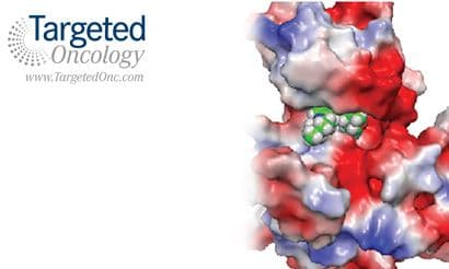 Precision Medicine in Sarcoma Pinpoints Tropomyosin-Related Kinases