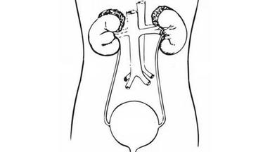 Sacituzumab Govitecan Continues to Show Efficacy in Pretreated mUC