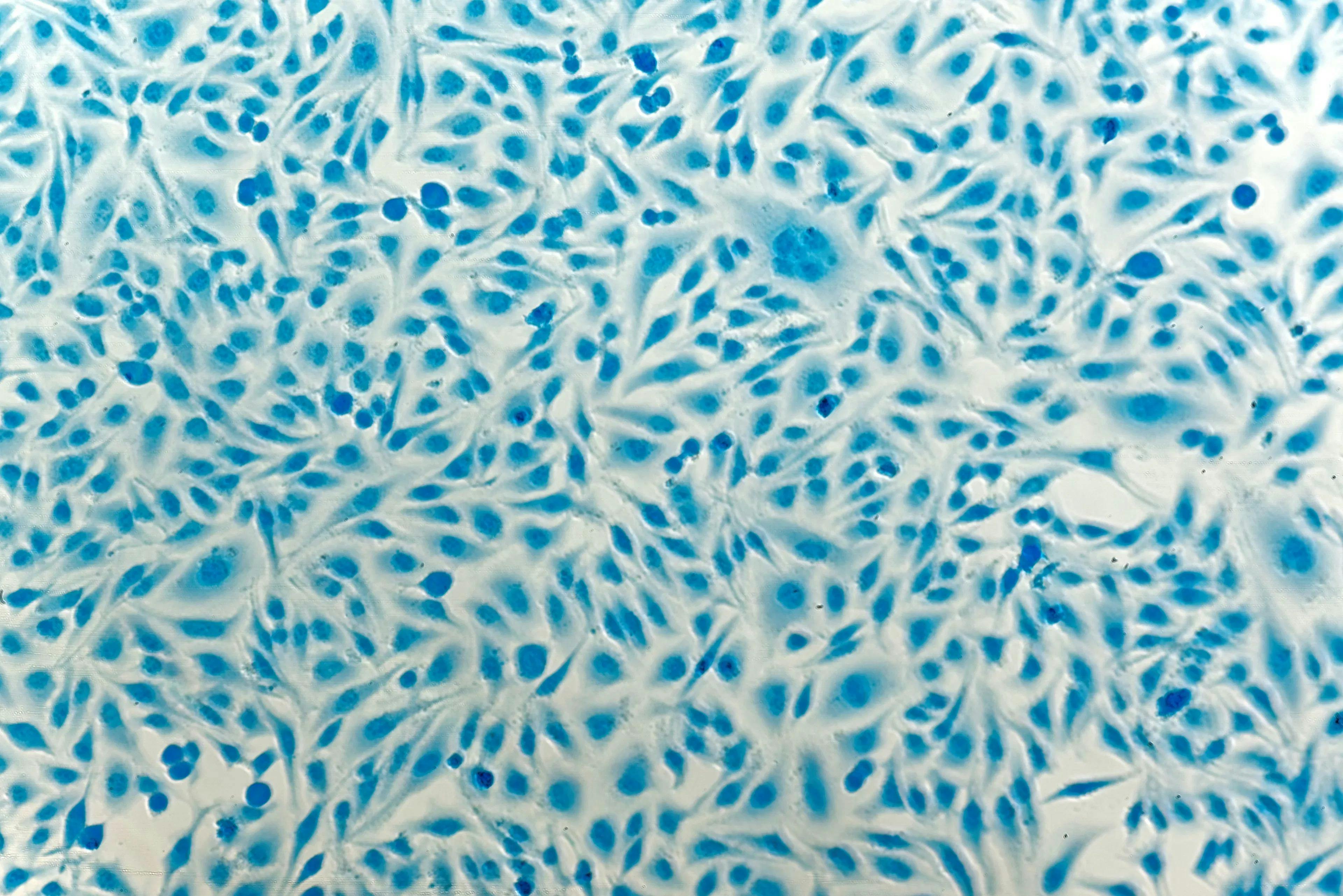 Cervical cancer cells - stock.adobe.com